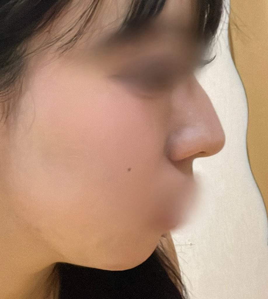 bae 鼻DT 8月脂肪吸引🇰🇷 tweet media