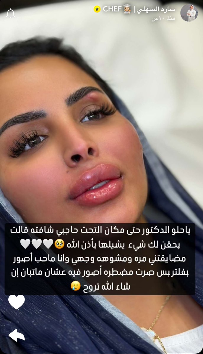 أرابيكا | Arabica tweet media