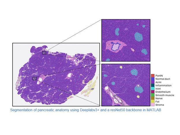 MATLAB_Japan's tweet image. がん発生プロセスの解明へ。

MATLABによるイメージレジストレーションやディープラーニングを用い、連続した組織切片から高精度な3D組織モデルを再構築する計算プラットフォーム「CODA」の事例をご紹介します。

🔗 spr.ly/6014B6svoM

#MATLAB #DeepLearning #画像処理