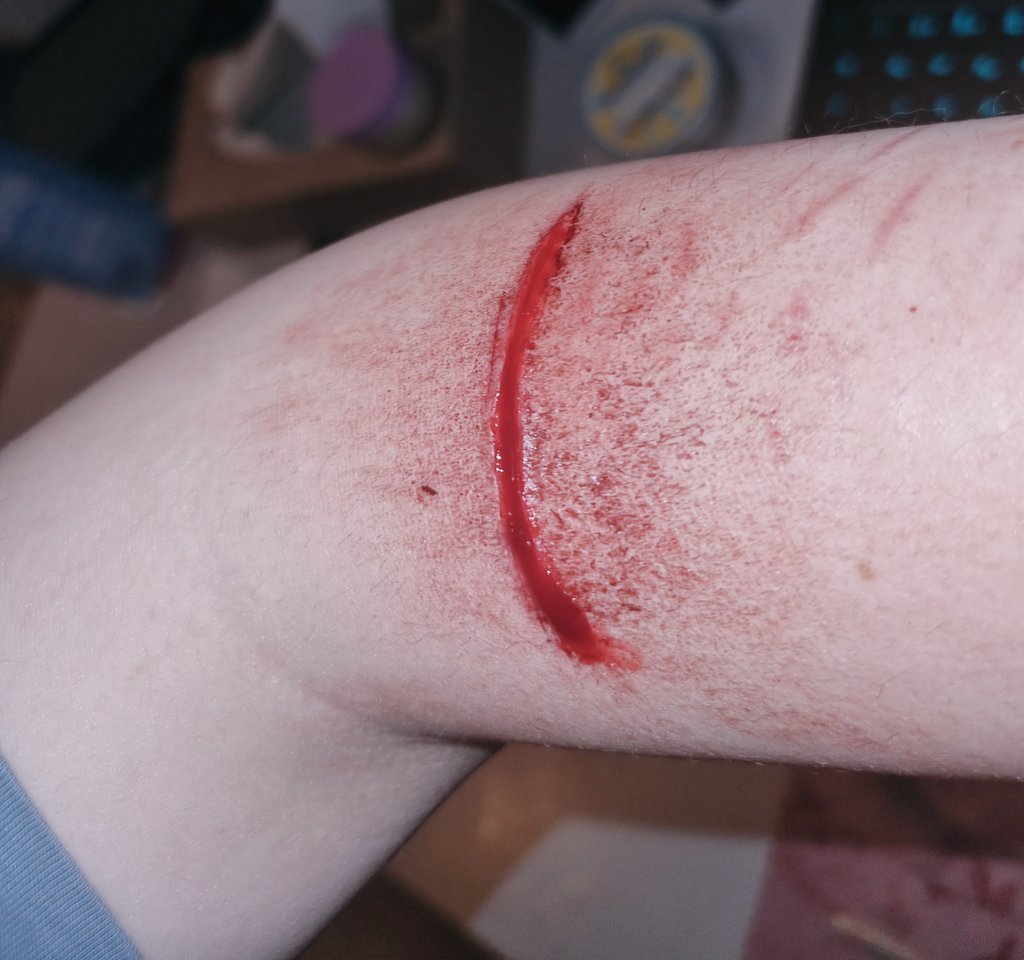 Empty ! shedtwt 0days binge free tweet media