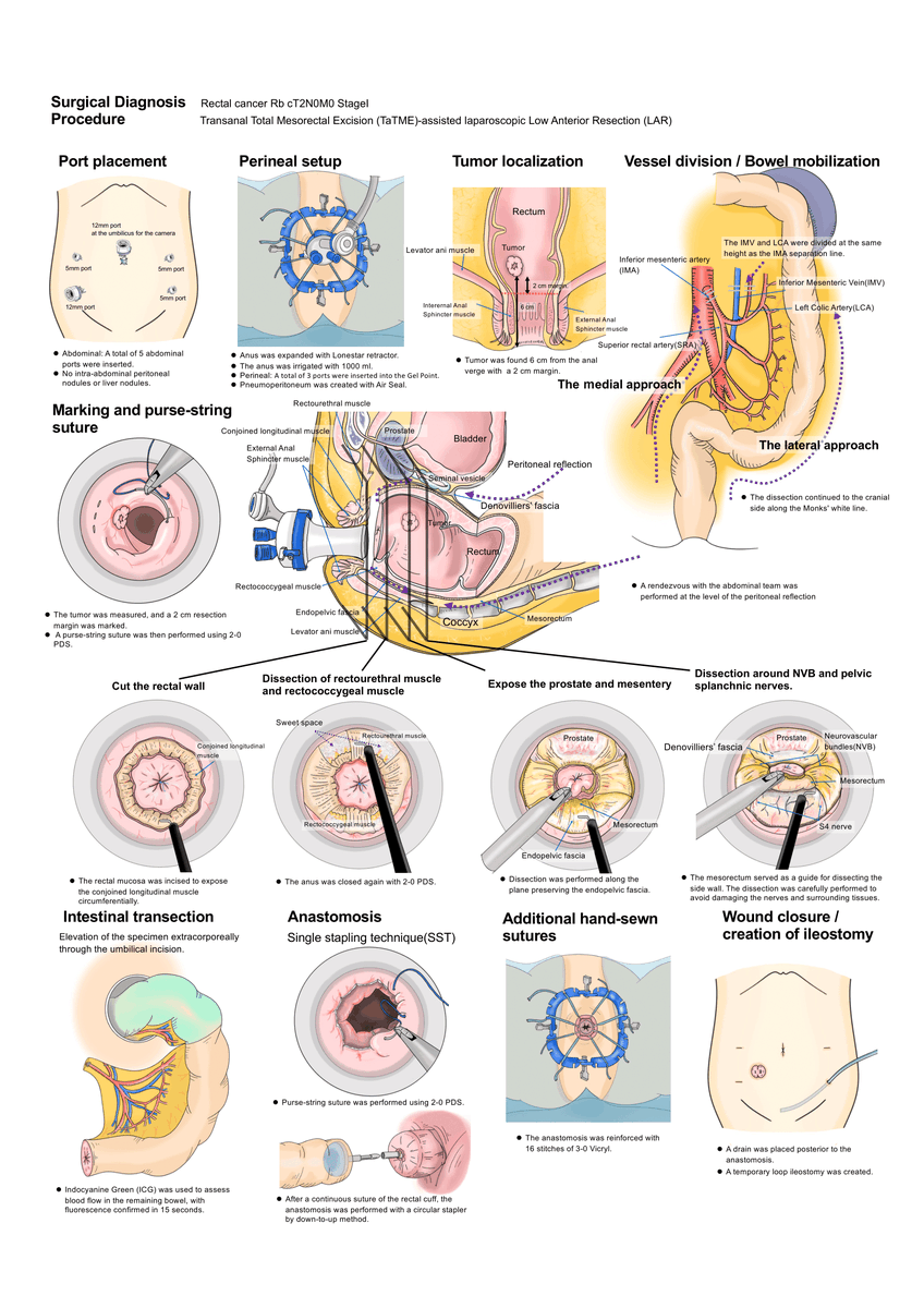 Japan Society for Endoscopic Surgery (JSES) tweet media