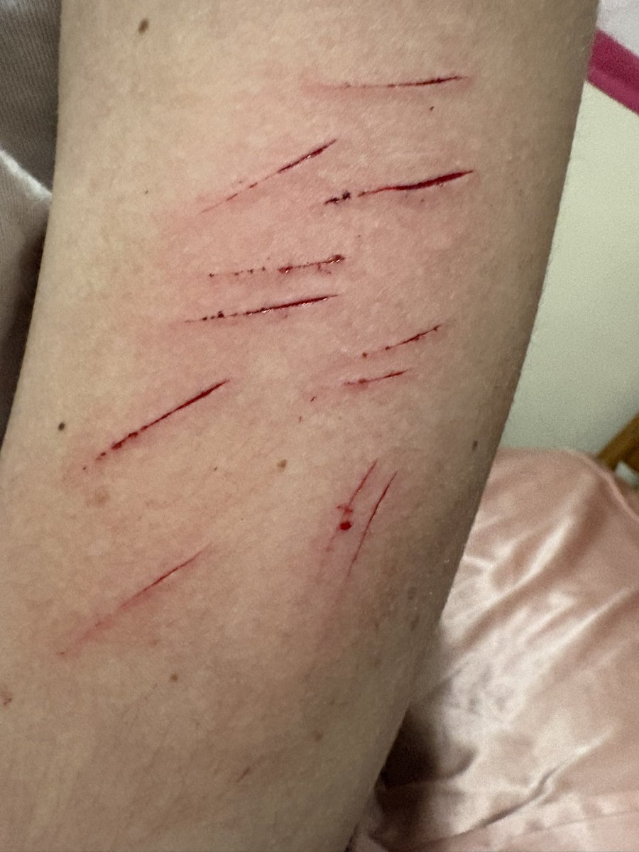 Armin Arlert of Shedtwt tweet media