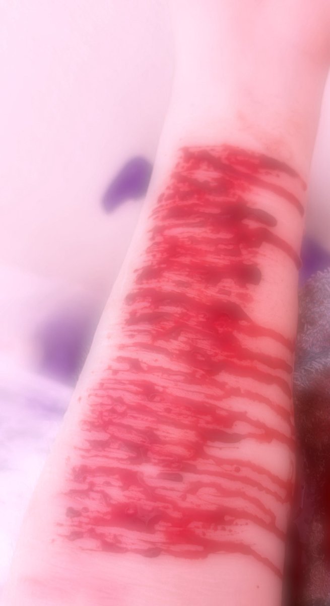 nazurexia's tweet photo. tw sh //

ermmm relapse even tho im supposed to be recovered !!!! :3 https://t.co/vqYUDDhtfV