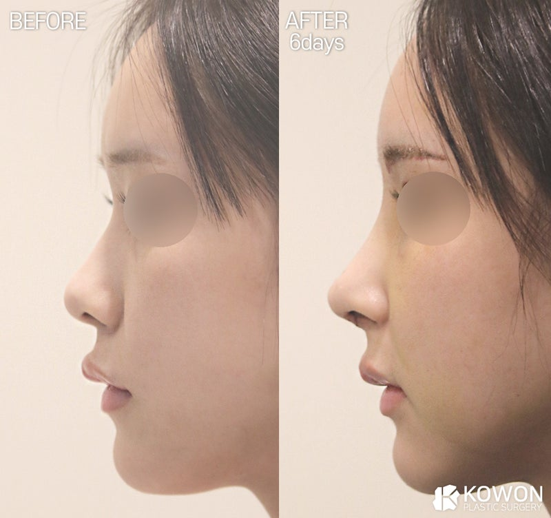 Dr.KimHT (コウォン整形外科) tweet media