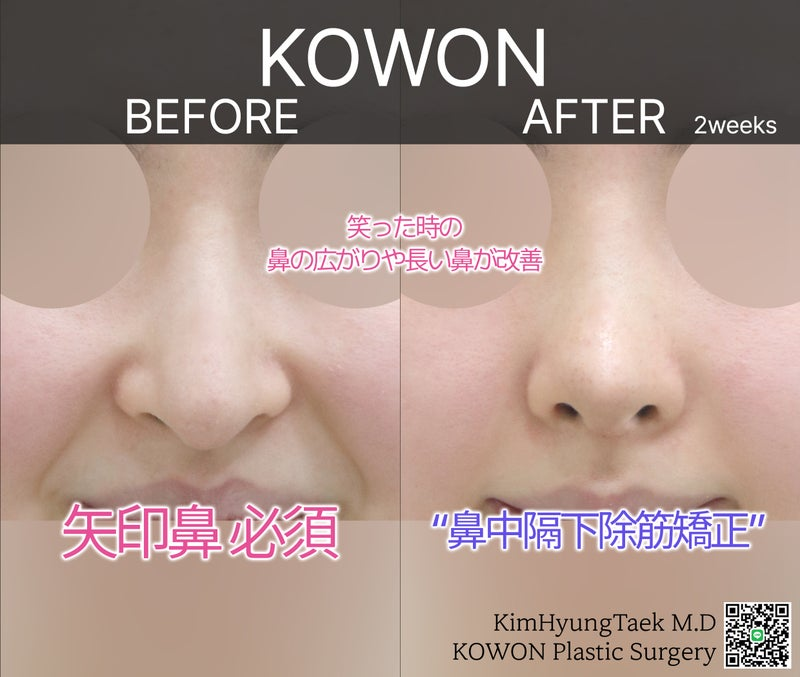 Dr.KimHT (コウォン整形外科) tweet media