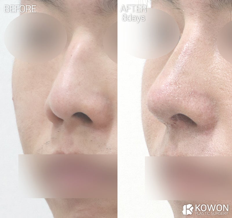 Dr.KimHT (コウォン整形外科) tweet media