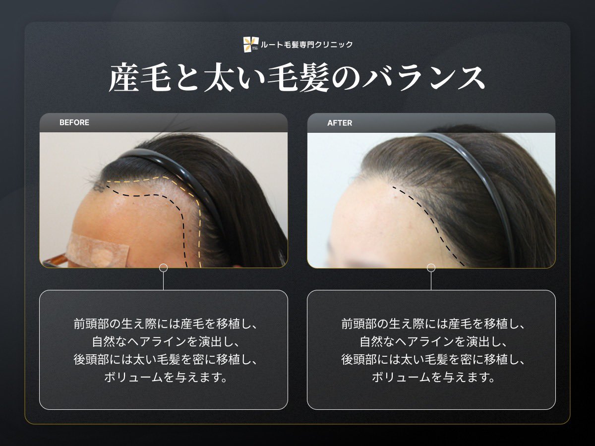 あられちゃん tweet media