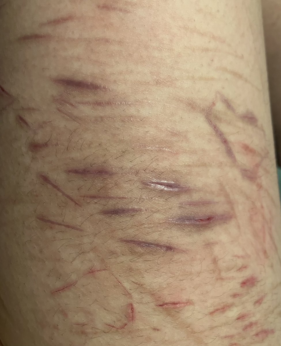 ┆🍥 ⤷ ძᥲᥒ (𖦹﹏𖦹;) tweet media