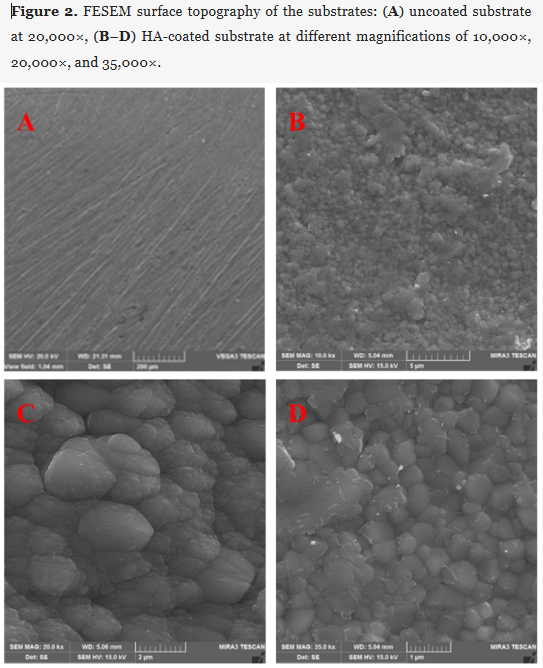 New in Prosthesis: "Surface Modification of Zirconia with Thick Hydroxyapatite Film Using RF Magnetron Sputtering Technique"

by Safi et al.

🔓 #Open_Access, free to read at: brnw.ch/21x1lla

#Prosthetics #ZirconiaImplants #Hydroxyapatite