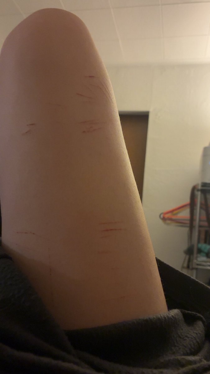 Echo🤍 tweet media