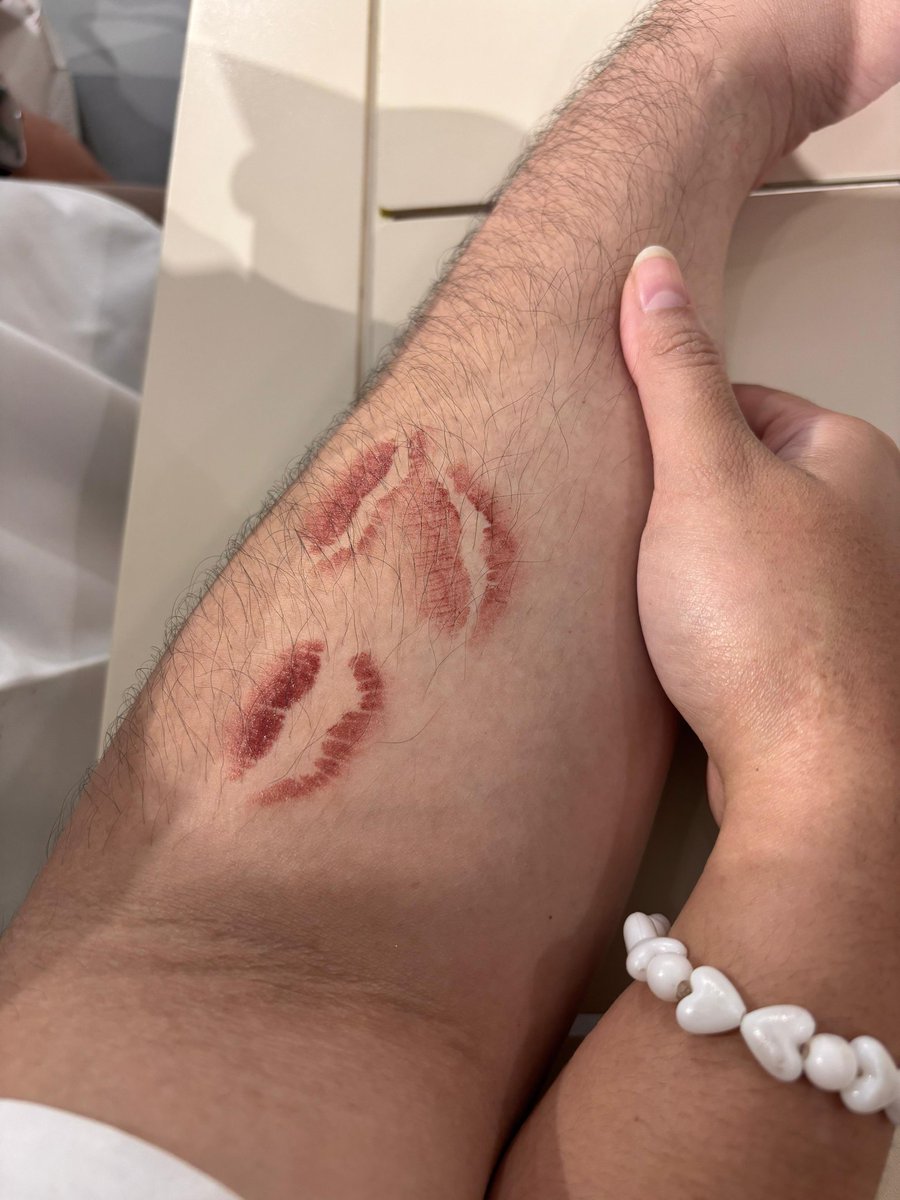 justkoko tweet media