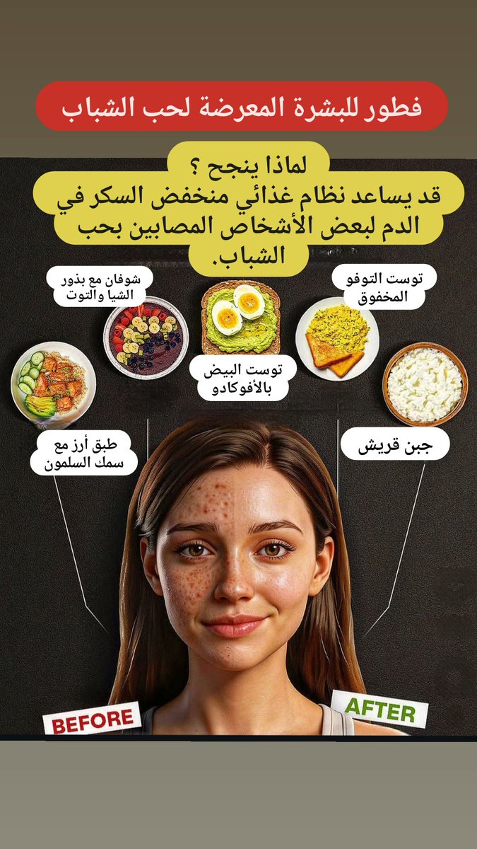 فطور للبشرة المعرضة لحب الشباب