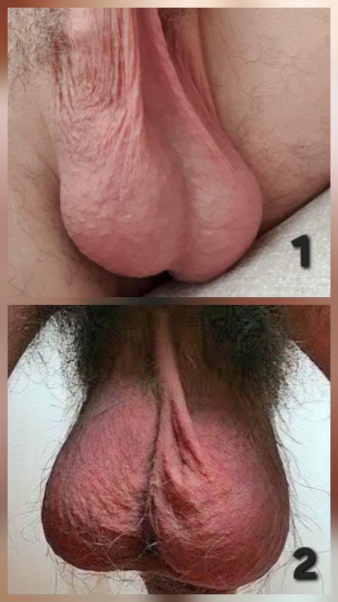 UnHombre tweet media