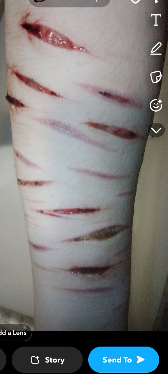 Simon of shedtwt tweet media