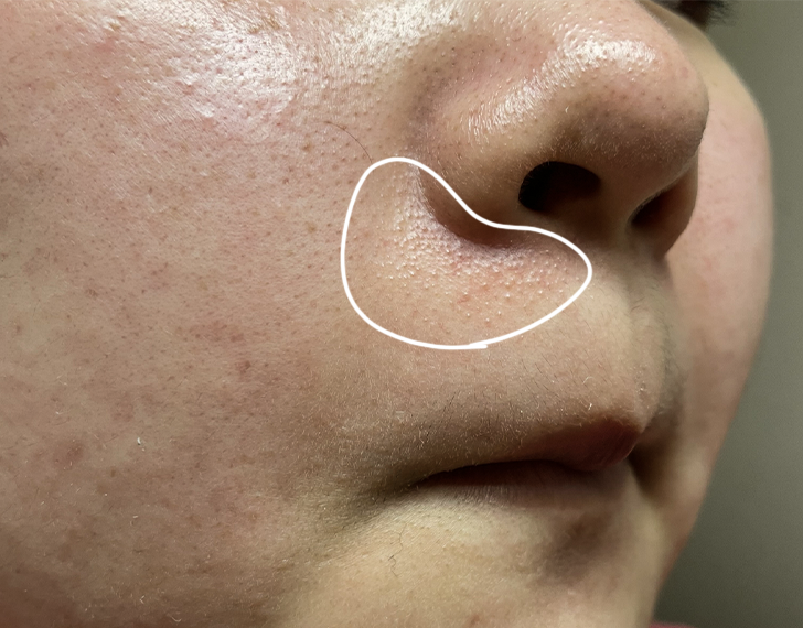 めぐ🐰🍓 tweet media