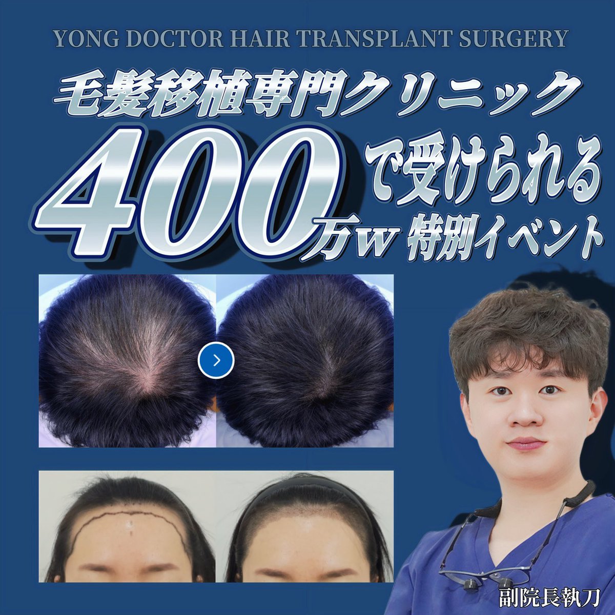 【韓国毛髪移植】AGA治療ヨンドクター(YONG Dr.) tweet media