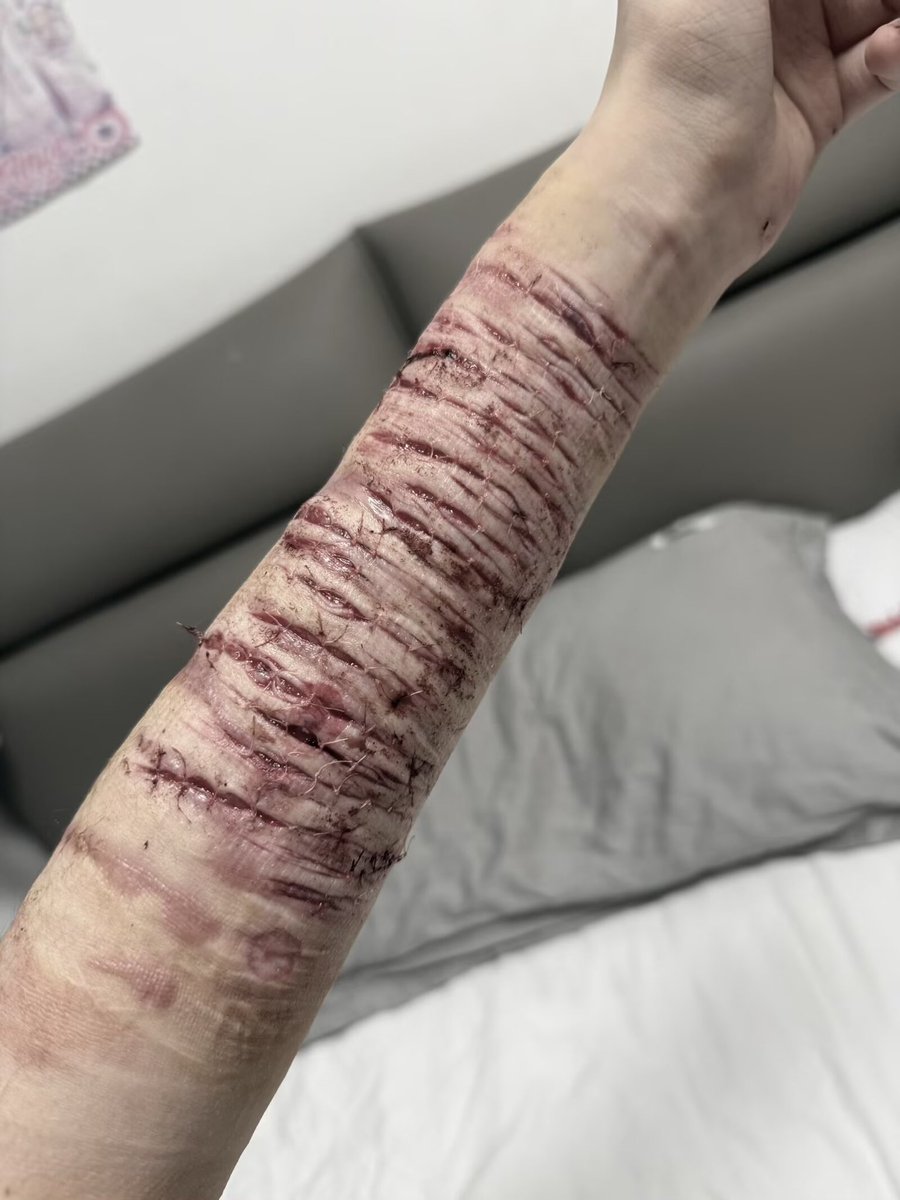 好想吃🫐巴菲 tweet media