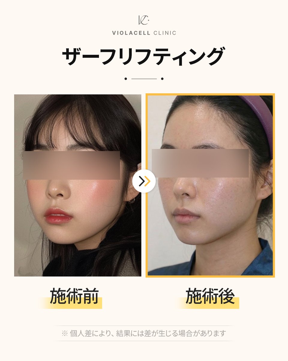 ビオラセルクリニック｜ VIOLACELL CLINIC tweet media