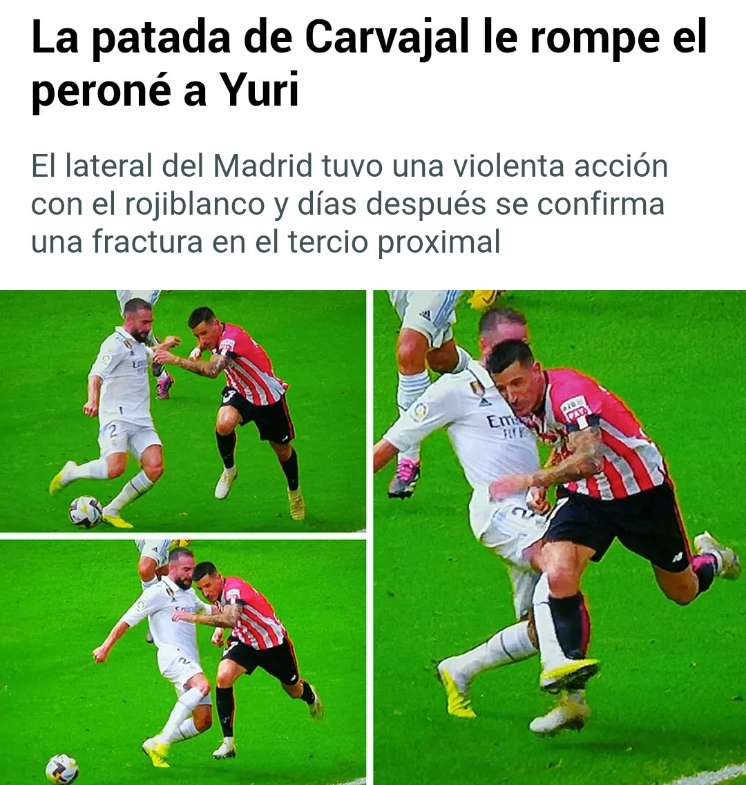 Loco tweet media