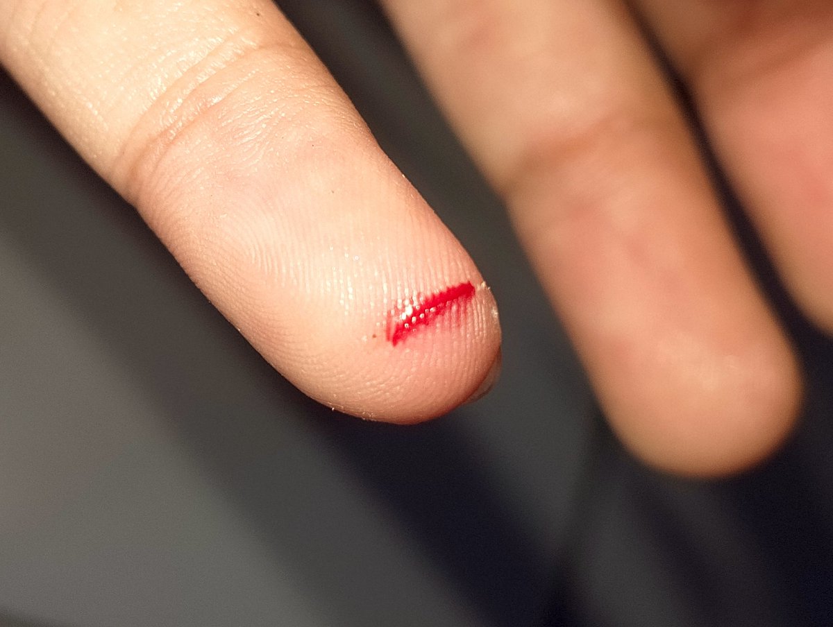 imsowrey's tweet photo. lagi motong bawang putih sambil mikir "semisal yang ku potong tanganku gmn ya" blm juga mingkem eh kepotong beneran😊😊 https://t.co/1CD9Atzdoo