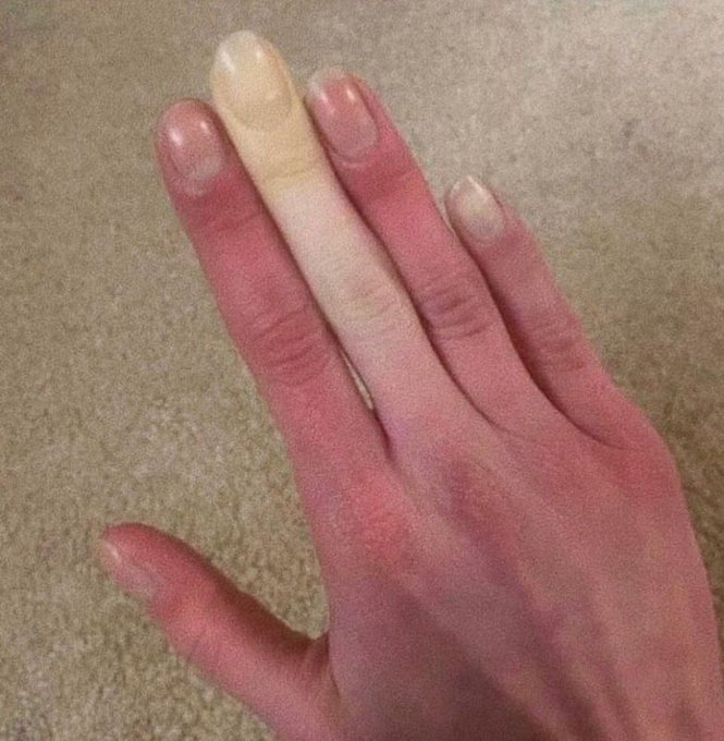 𝐑𝐢𝐧𝐚🐞 tweet media