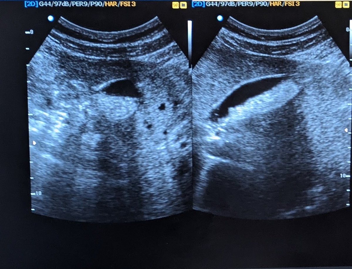 Bruno Natuhwera tweet media