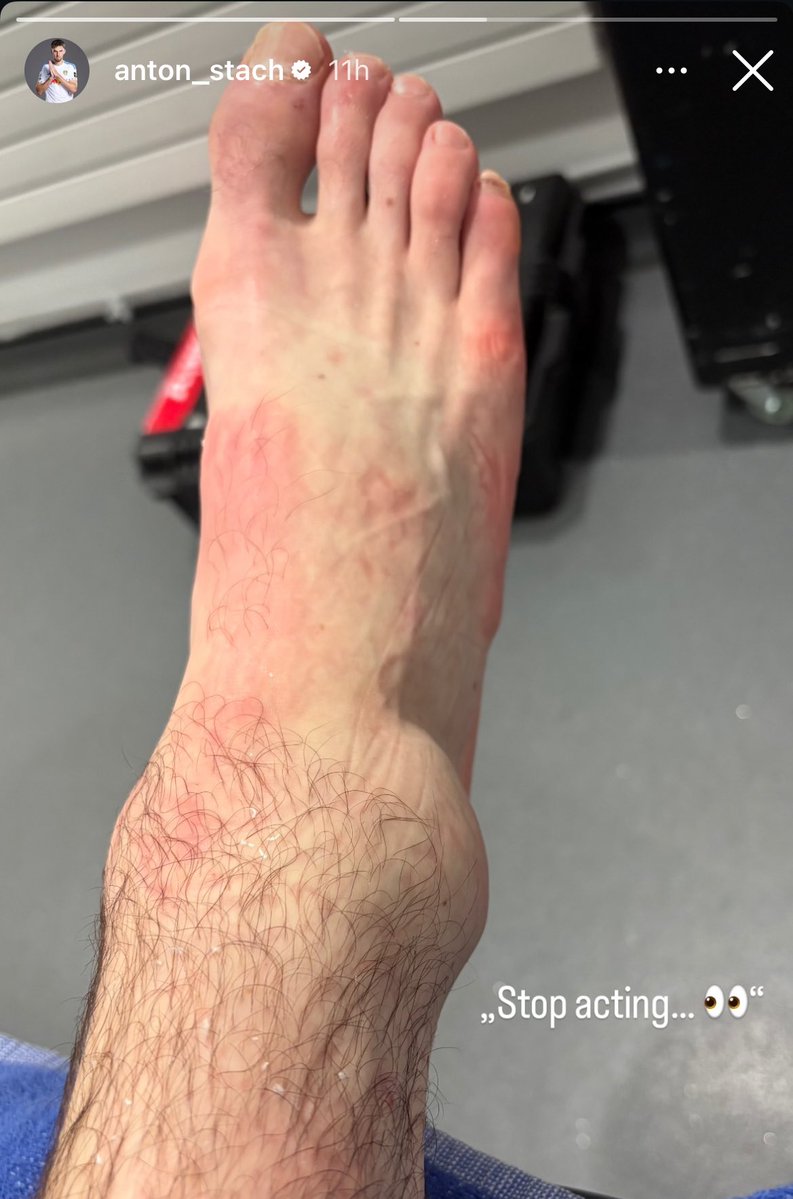 James Green tweet media