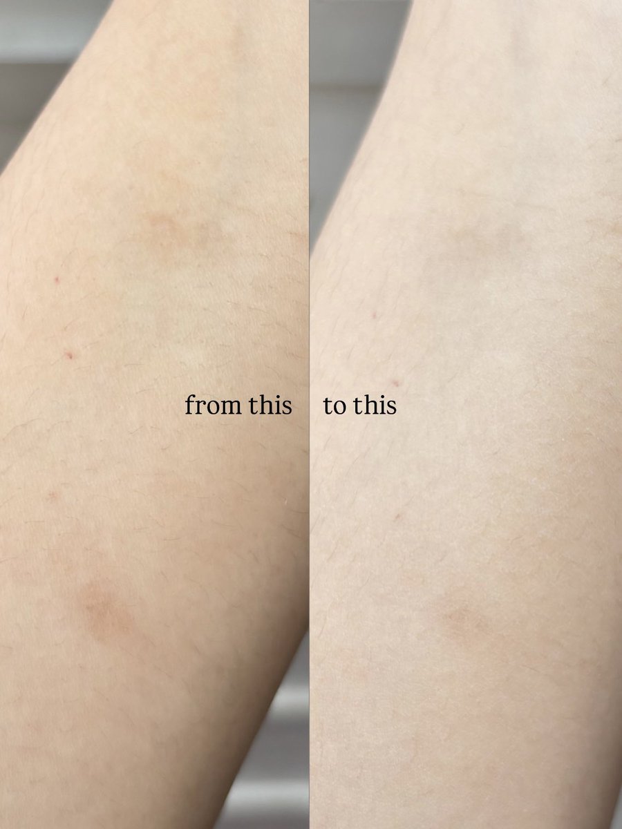 winda ✧˖° tweet media