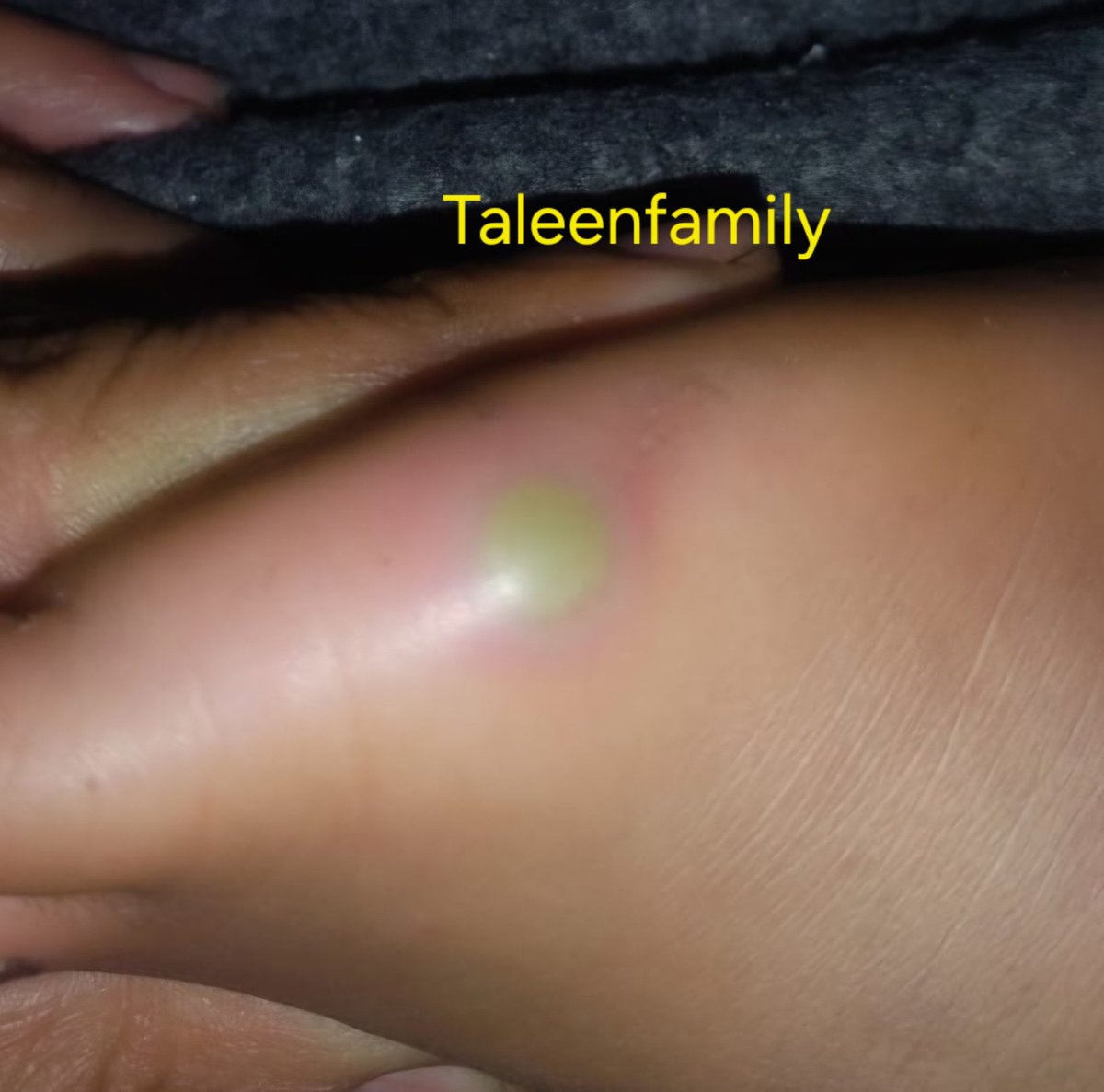 Taleen Family 🍉 tweet media