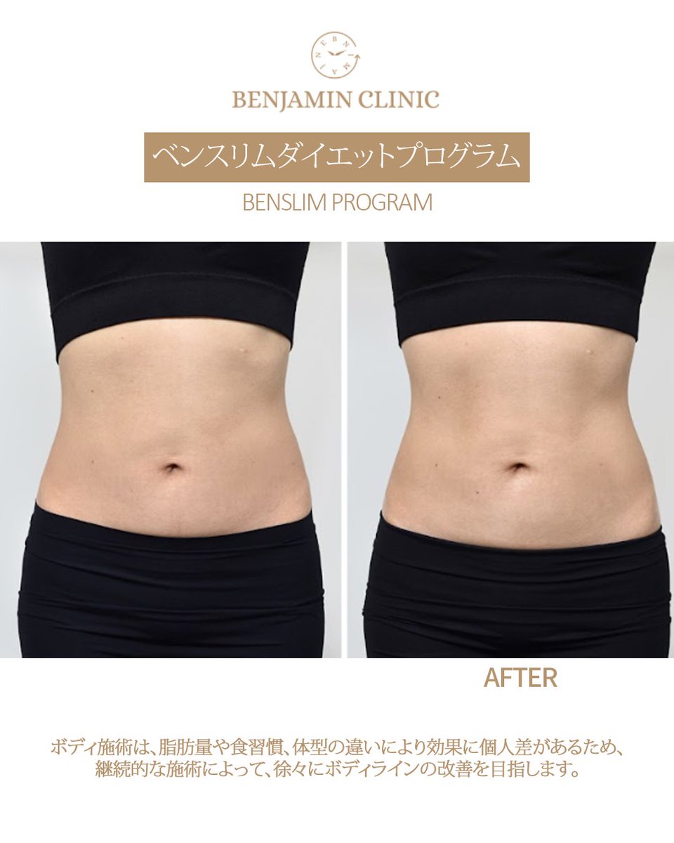 【韓国美容】ベンジャミンクリニック tweet media