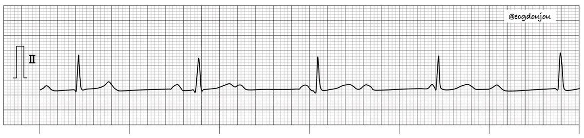 心電図道場 tweet media