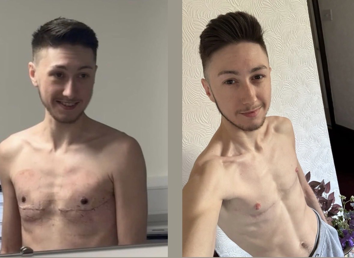 Tristan Simmonds tweet media