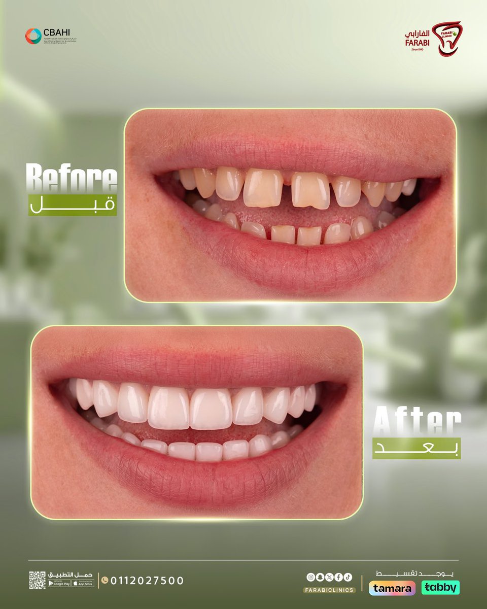 عيادات الفارابي tweet media