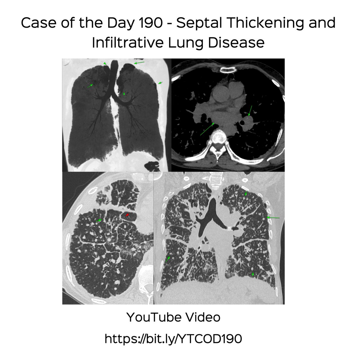 Bhavin Jankharia tweet media