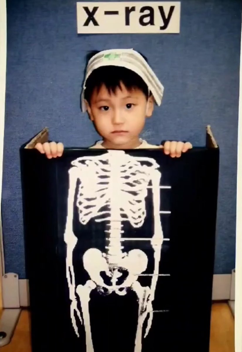 유독 이 사진에서 애기 때 얼굴이 많이 보이는 듯 .. 무뚝뚝 왕자님😼👑