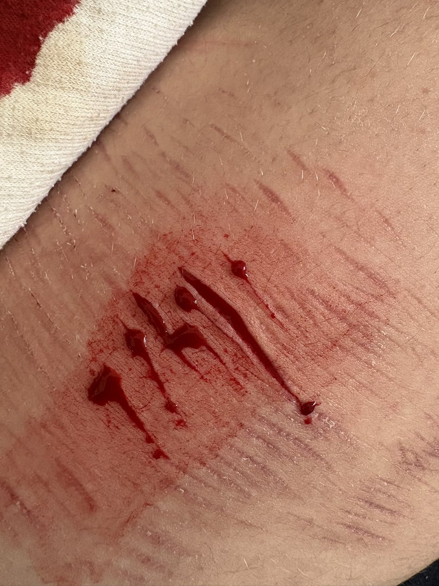 ๐ธ๐๐๐๐๐ฑ๐๐๐๐ ๐บ๐ ๐พ๐๐๐๐ tweet media