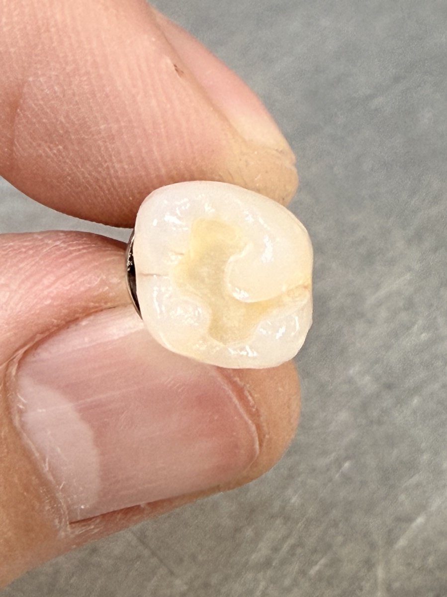 歯のおもちゃ屋さん🦷 tweet media