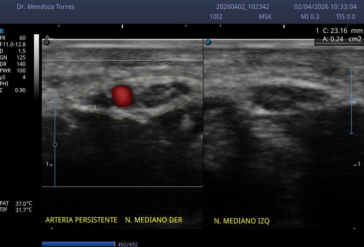 Dr. Mendoza Torres tweet media