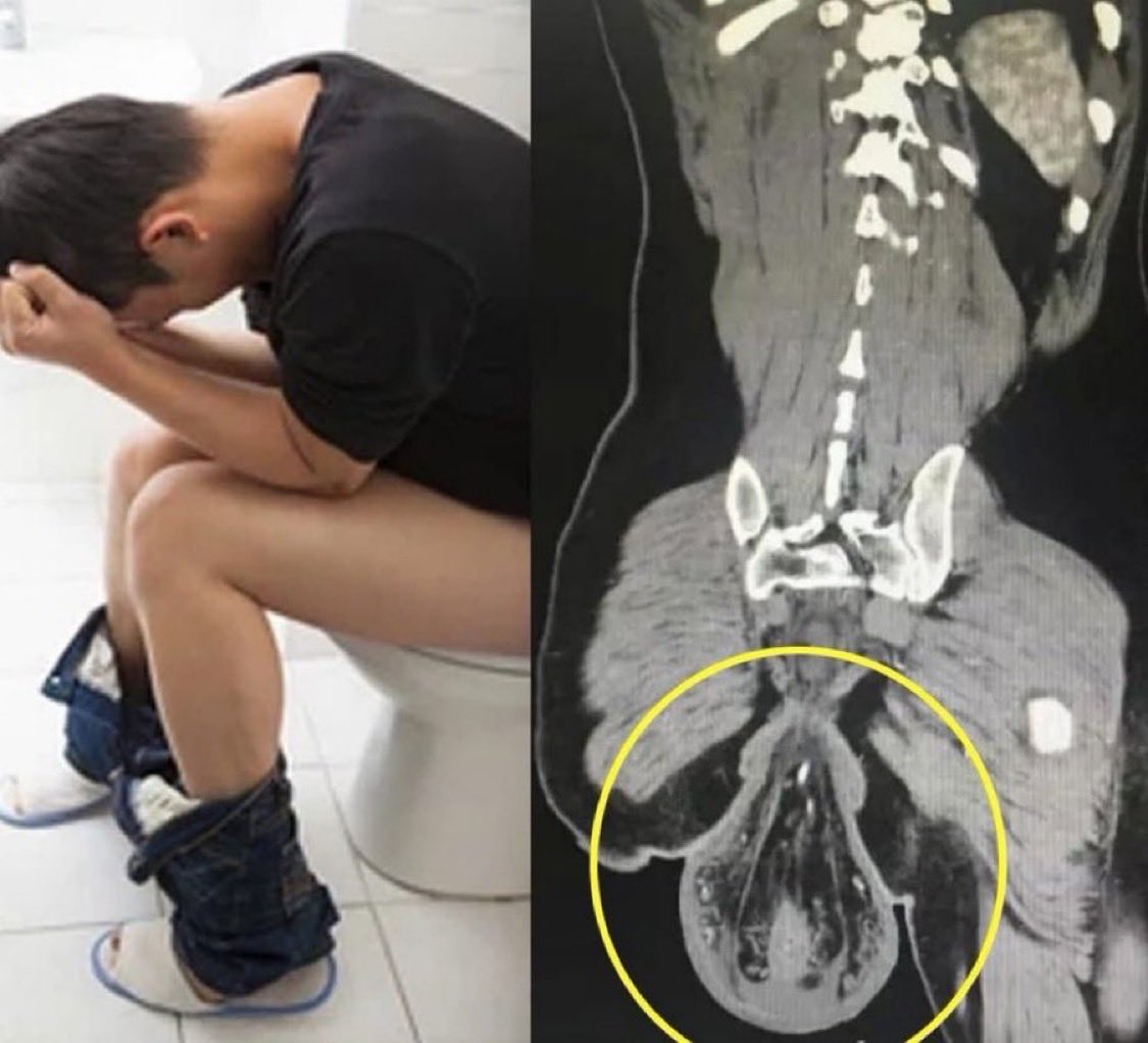 Esref Larsen tweet media