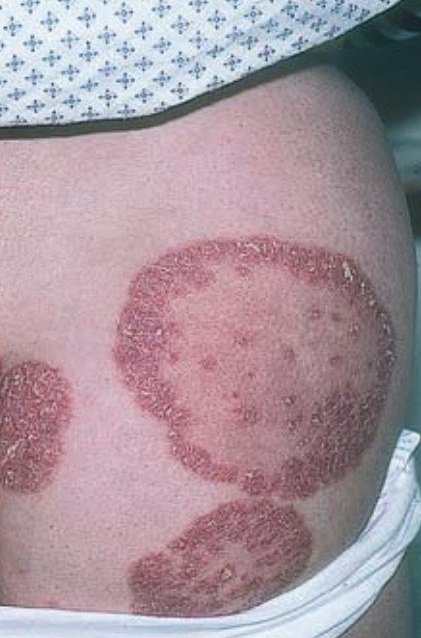 IhabFathiSulima's tweet image. What is the diagnosis ⁉️