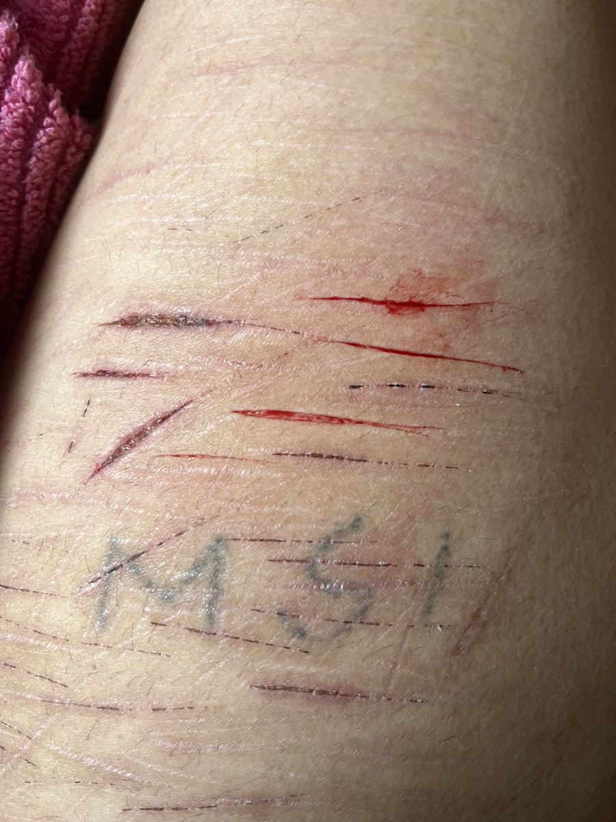 🧁𝘾𝙚𝙣𝙩𝙞𝙥𝙚𝙙𝙚-𝙘𝙝𝙖𝙣🐾// 𝙨𝙝𝙚𝙙𝙩𝙬𝙩 tweet media