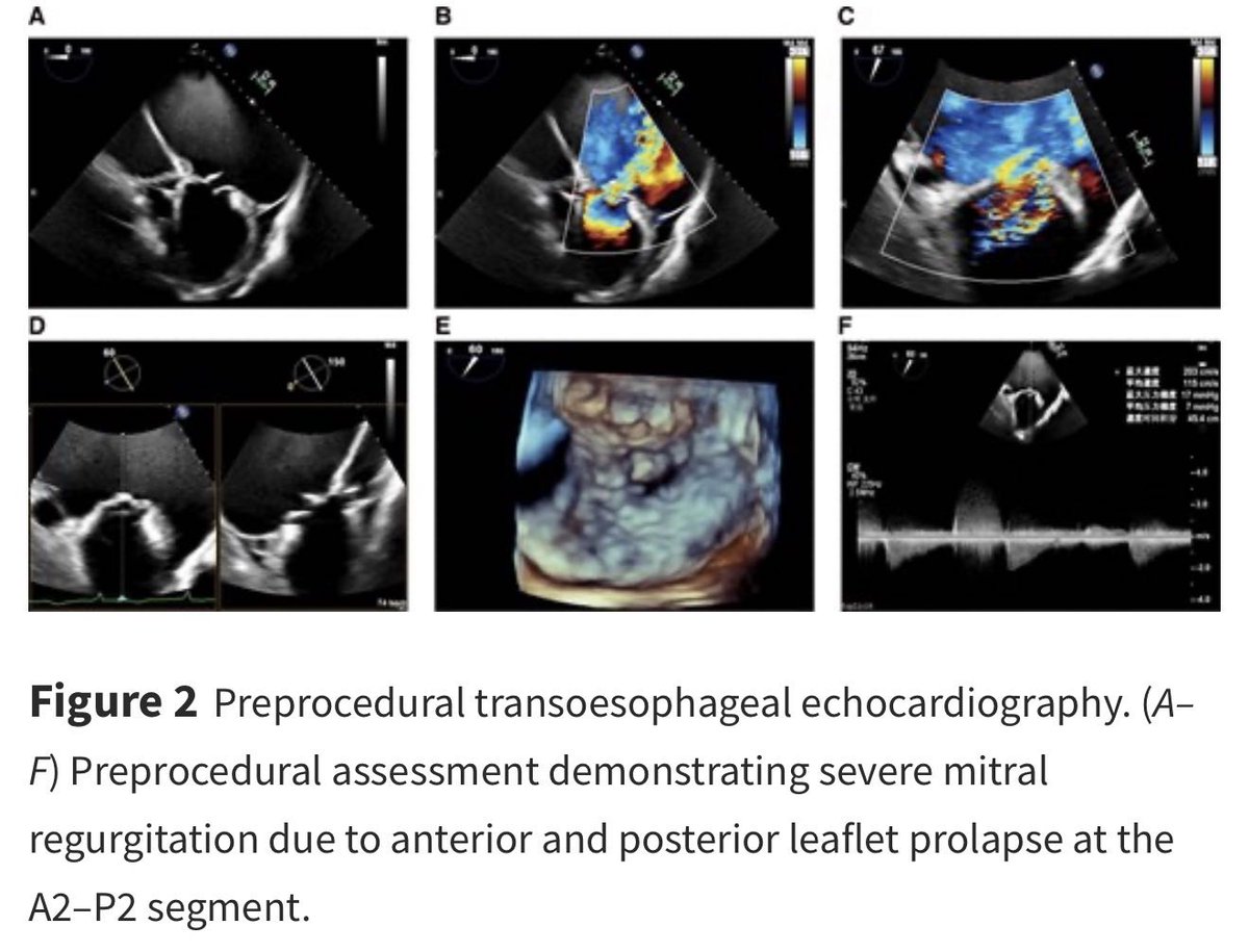 European Society of Cardiology Journals tweet media