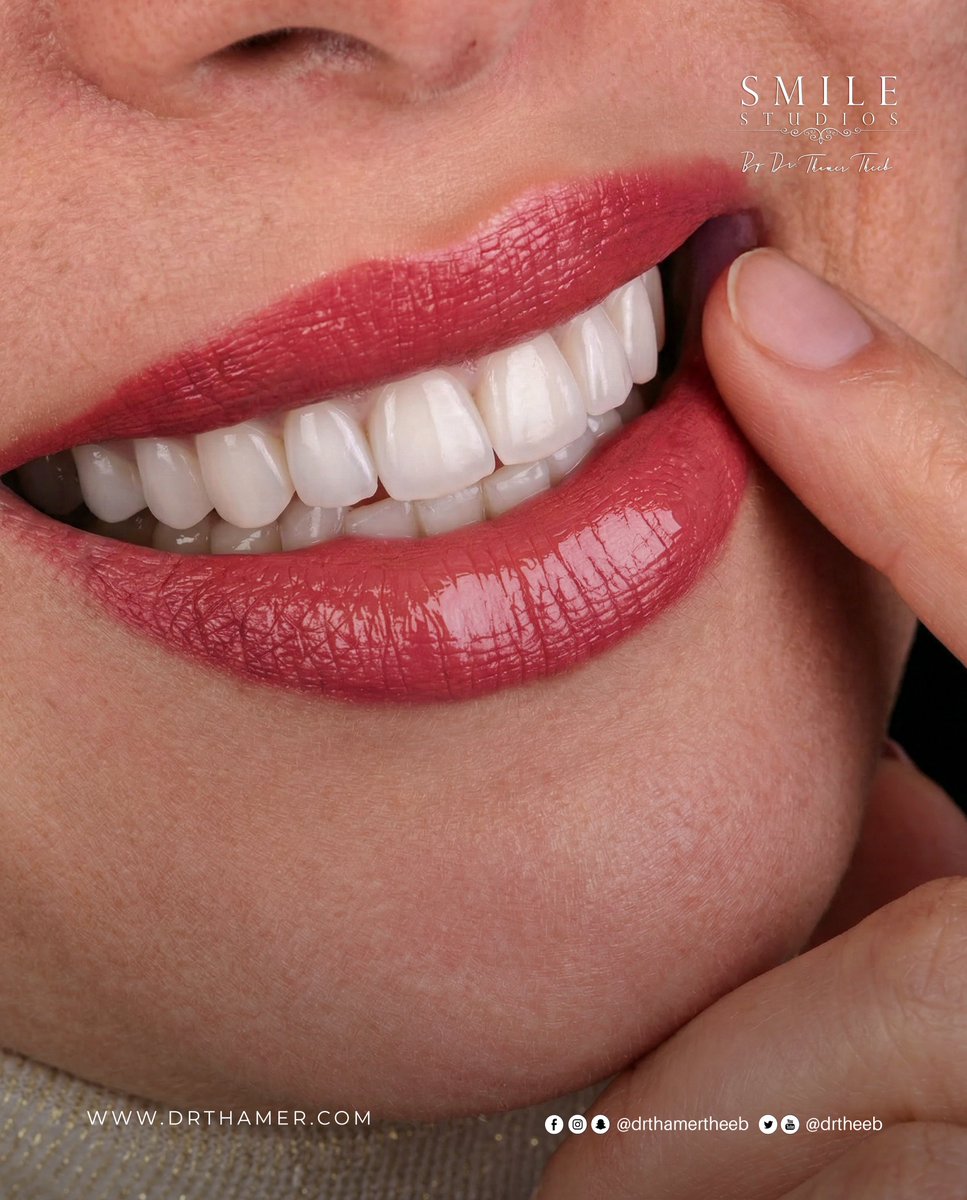 drtheeb's tweet photo. لأن الأناقة الحقيقية لا تُقال… بل تُرى في ابتسامتك
Where Elegance Becomes a Smile

#DrThamerTheeb #SmileStudios #CosmeticDentistry #LuxurySmile #DentalAesthetics #Amman #Jordan #ابتسامة #تجميل_الأسنان #عمان https://t.co/PL9XIiYlyV