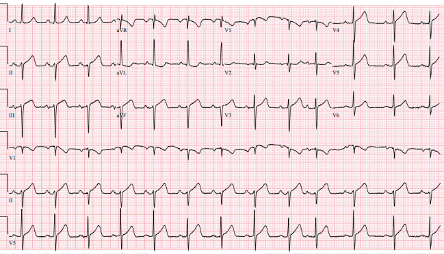 ECGWeekly tweet media