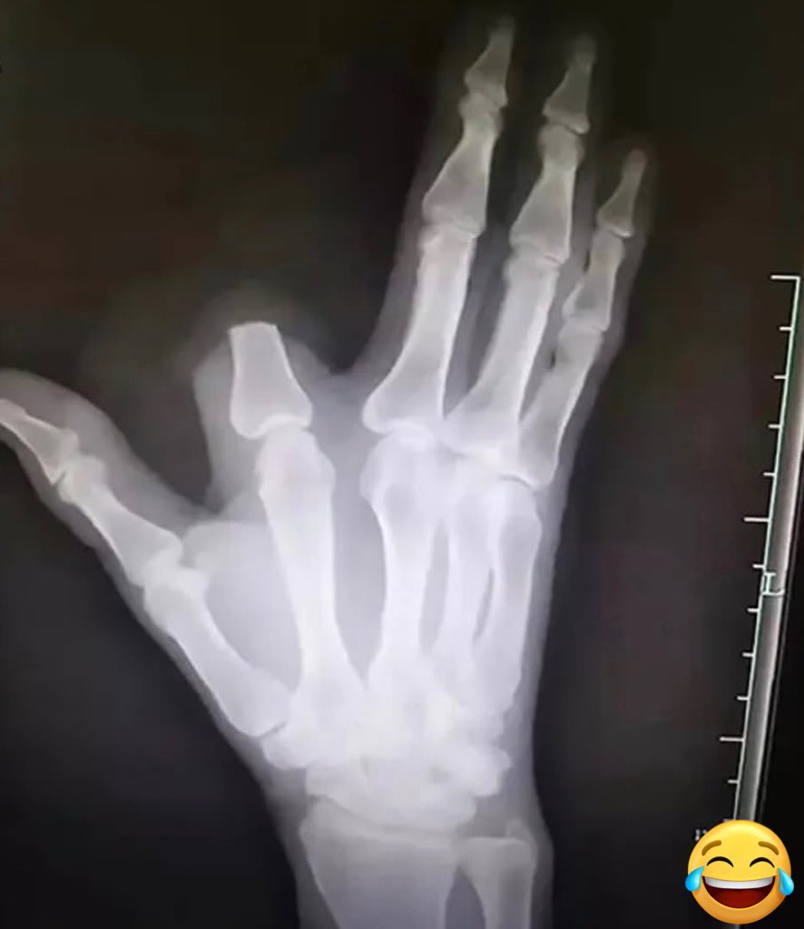 manuelmanchi tweet media