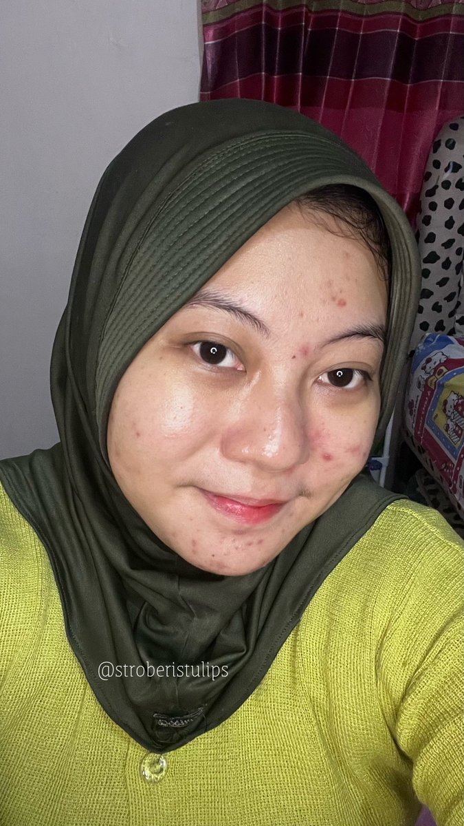 Sebelum cobain SKIN1004 kataku si harus cobain dulu yg varian travel kitnya, baru kalo cocok bole ganti ke yg versi gedenya🫠🫶

Lezzgooo kita ripiu satu satu xixi👇