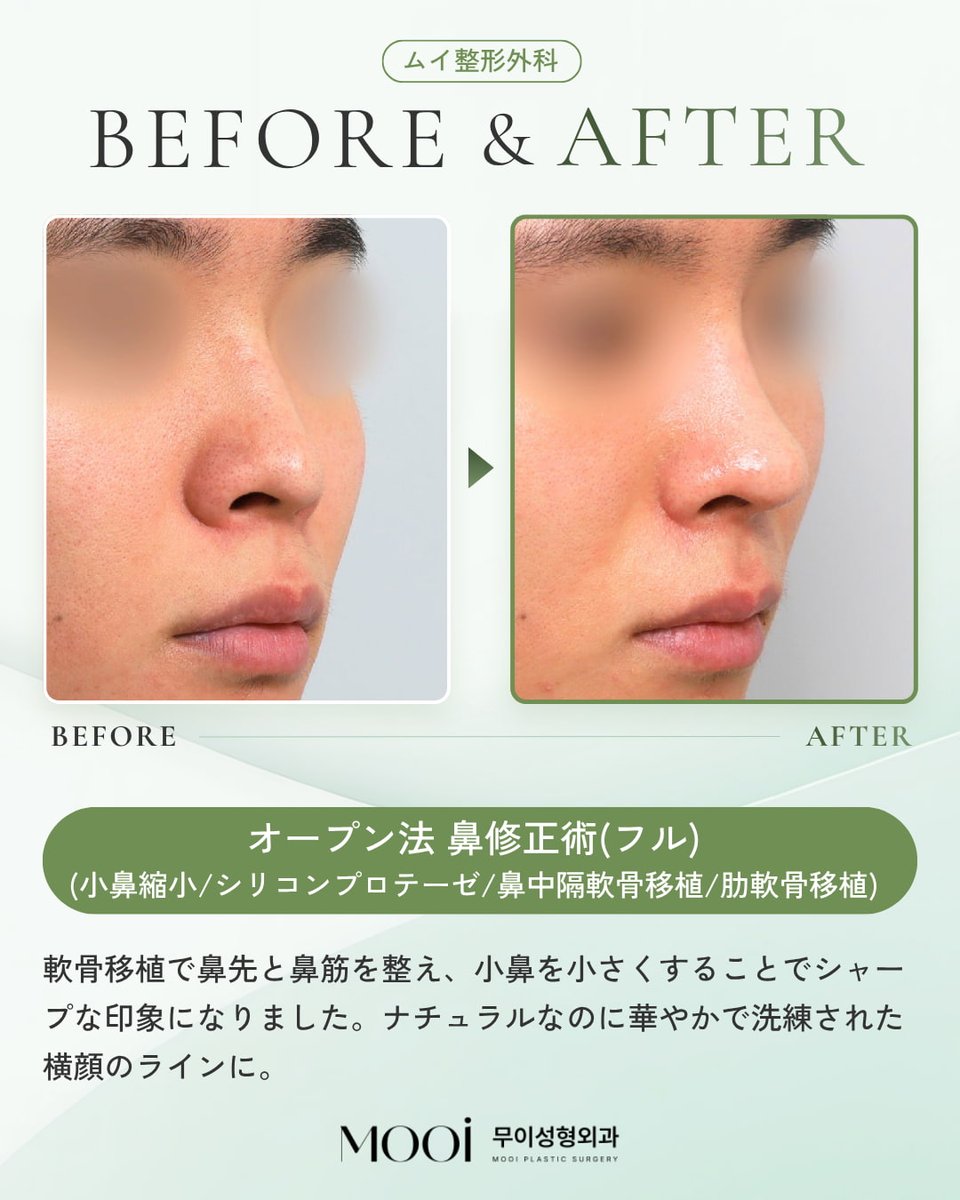 MOOi (ムイ) 整形外科 tweet media