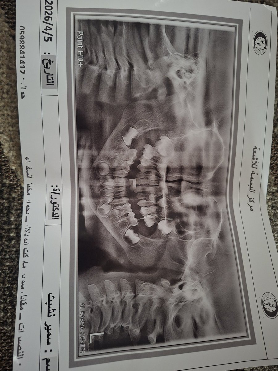 AlaaSamir0599's tweet photo. My child is in pain because of his teeth, please help him
Please help my child. Please donate and share. 
https://t.co/D9jezpQMUG https://t.co/viFaCLaMBu