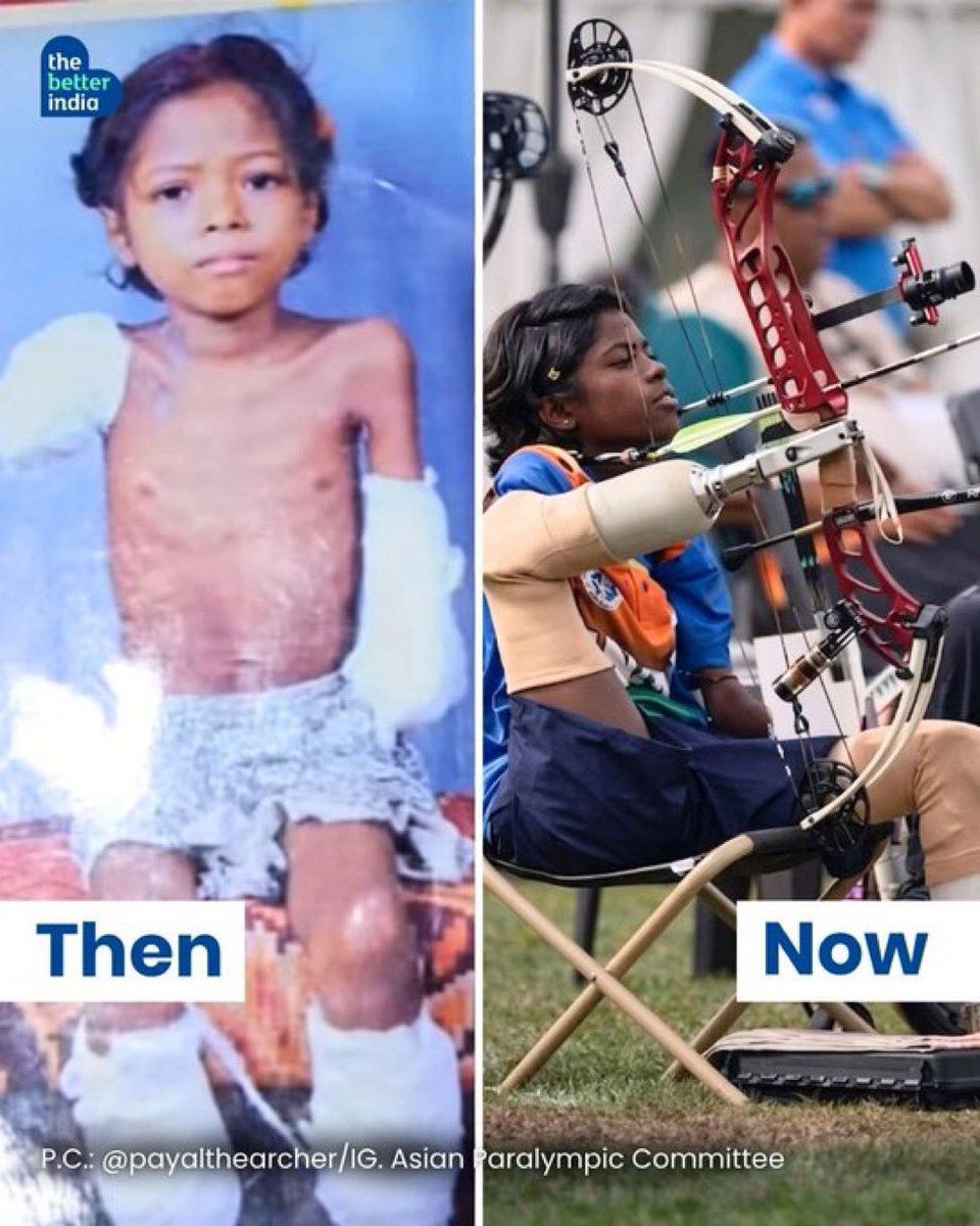 Dr. B L Bairwa MS, FACS tweet media