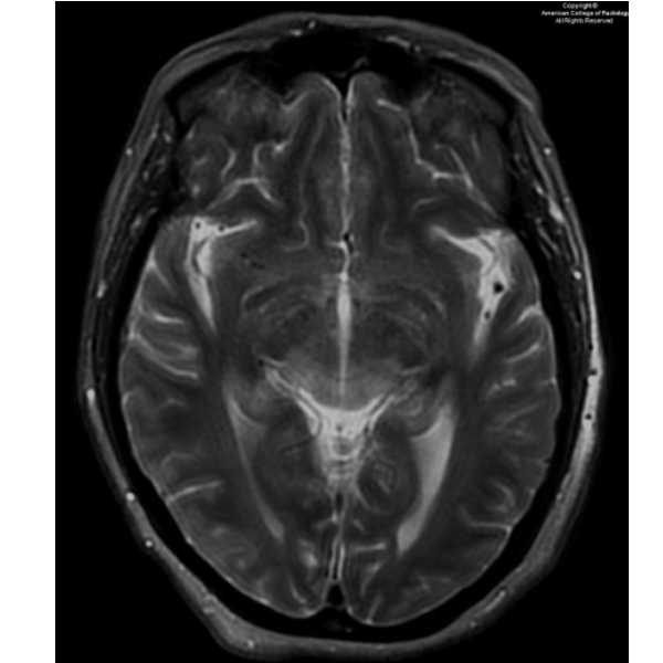 American College of Radiology tweet media